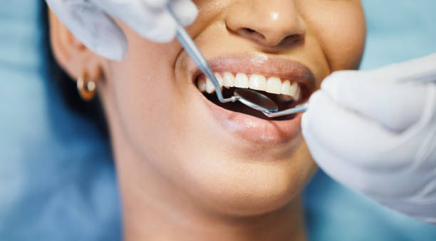 Best After-Hours Emergency Dentist in Sebastopol, CA